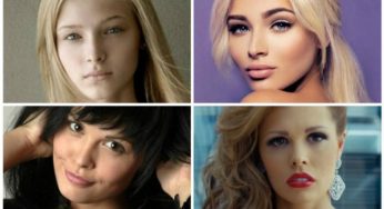 12 российских красавиц после ножа пластики
