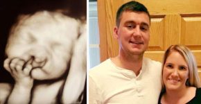 Родители не стали делать аборт из-за деформации губы у ребенка – взгляните, как он выглядит сейчас