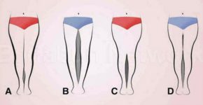 Вы даже не представляете, что о Вас расскажет форма ног! Выбирайте свою и…